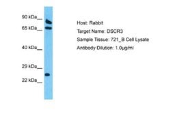 DSCR3 Rabbit anti-Human, Polyclonal, Novus Biologicals 0.1 mL | Buy Online | Novus Biologicals | Fisher Scientific